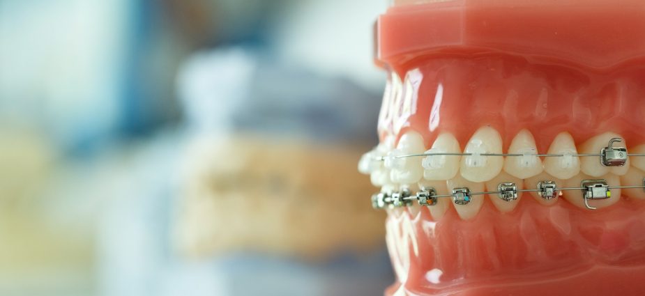 ارتودنسی نه تنها به عمل سیم‌کشی دندان‌ها، بلکه به یکی از شاخه‌های تخصصی دندانپزشکی نیز گفته میشود که به تشخیص و درمان ناهنجاری‌های فکی میپردازد.