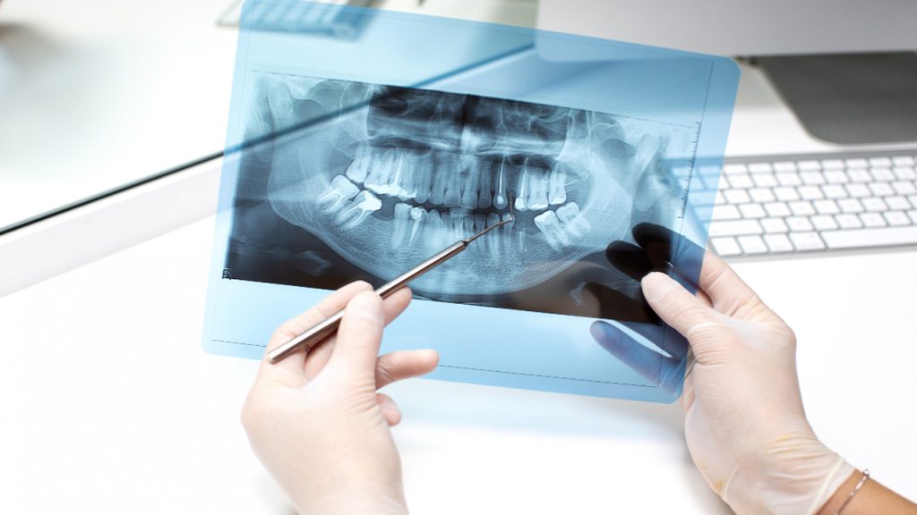 آناتومی دندان در واقع علمی است که به مطالعه ساختار دندان‌ها و اجزای مختلف آنها می‌پردازد