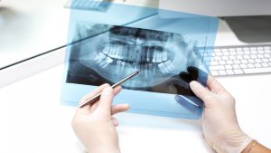 آناتومی دندان: شناخت اجزای مهم و وظایف آنها